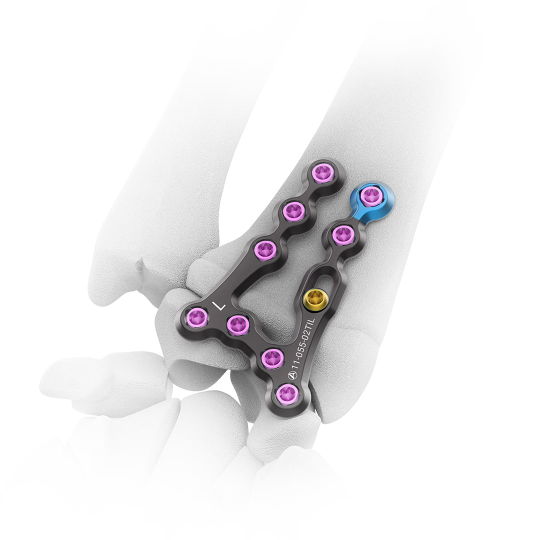 One stop Solution for All Orthopaedic Needs